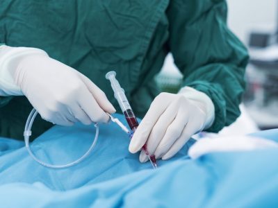 Prosedur Stent Jantung