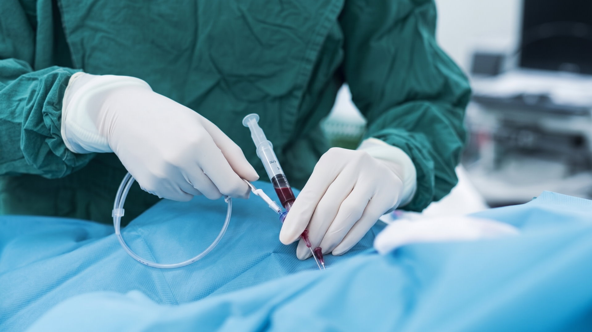 Prosedur Stent Jantung