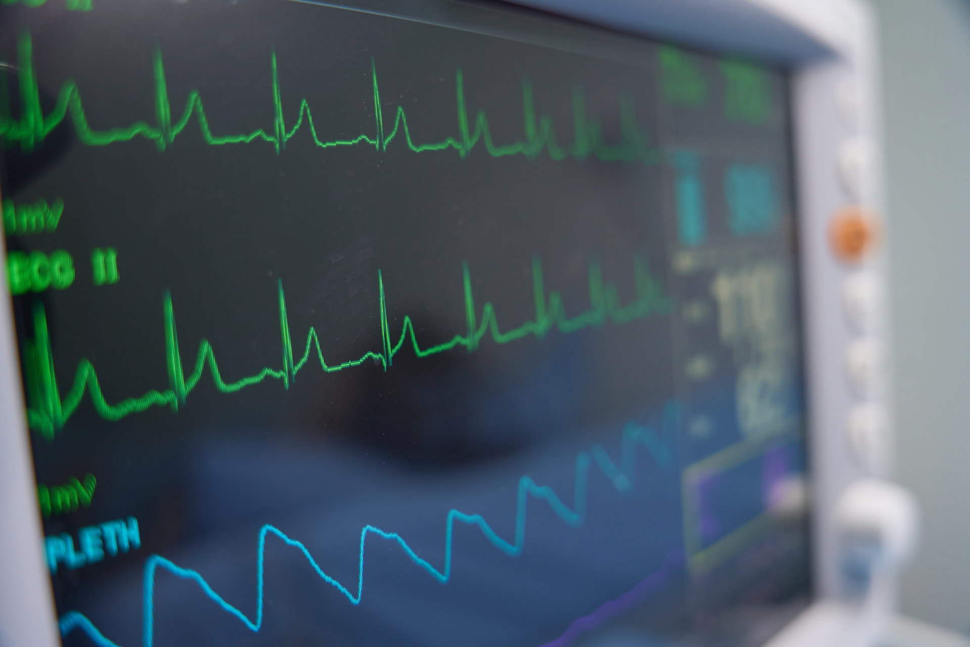 Kenali EKG Jantung: Manfaat, Proses Pemeriksaan, dan Interpretasi Hasil