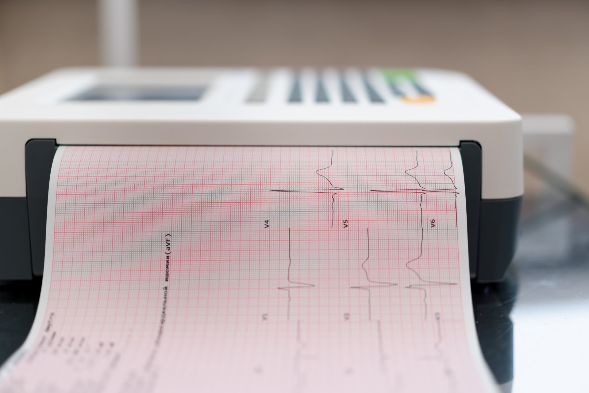 Panduan Lengkap EKG (Rekam Jantung): Prosedur, Fungsi, dan Kapan Harus Melakukannya